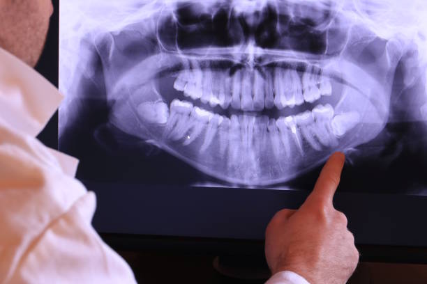 Best Emergency Wisdom Teeth Removal in Houston, PA